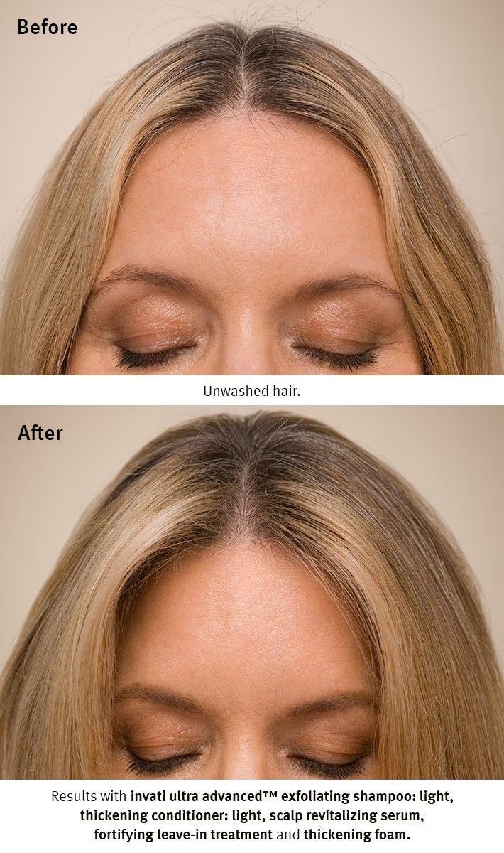 Aveda invati ultra advanced revitalizing scalp serum