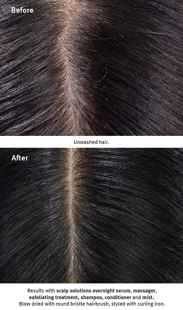 Aveda scalp solutions overnight scalp renewal serum