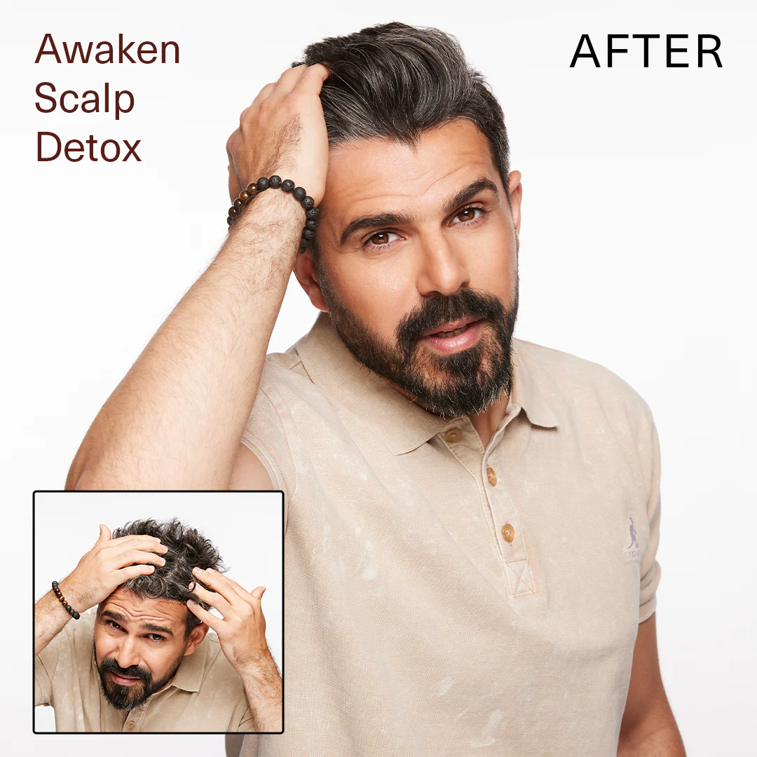 Surface Awaken Scalp Detox